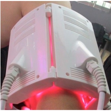 Lipolaser LIPODIODE - Dissolution des graisses