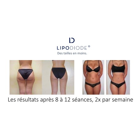 Lipolaser LIPODIODE - Dissolution des graisses