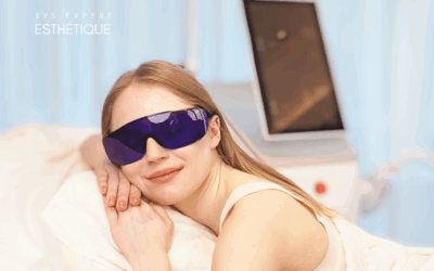 L’épilation au laser