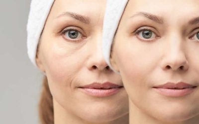 Les rides du visage et leur signification : décryptez votre beauté intérieure